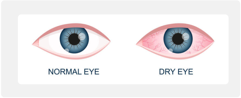 Aloka-Eye-Clinic-–-Figma-11-28-2025_11_24_PM